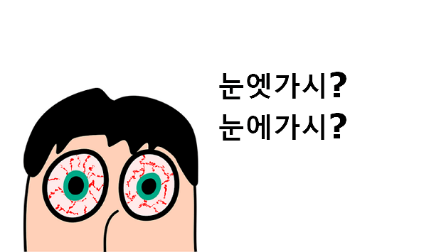 눈에가시 눈엣가시